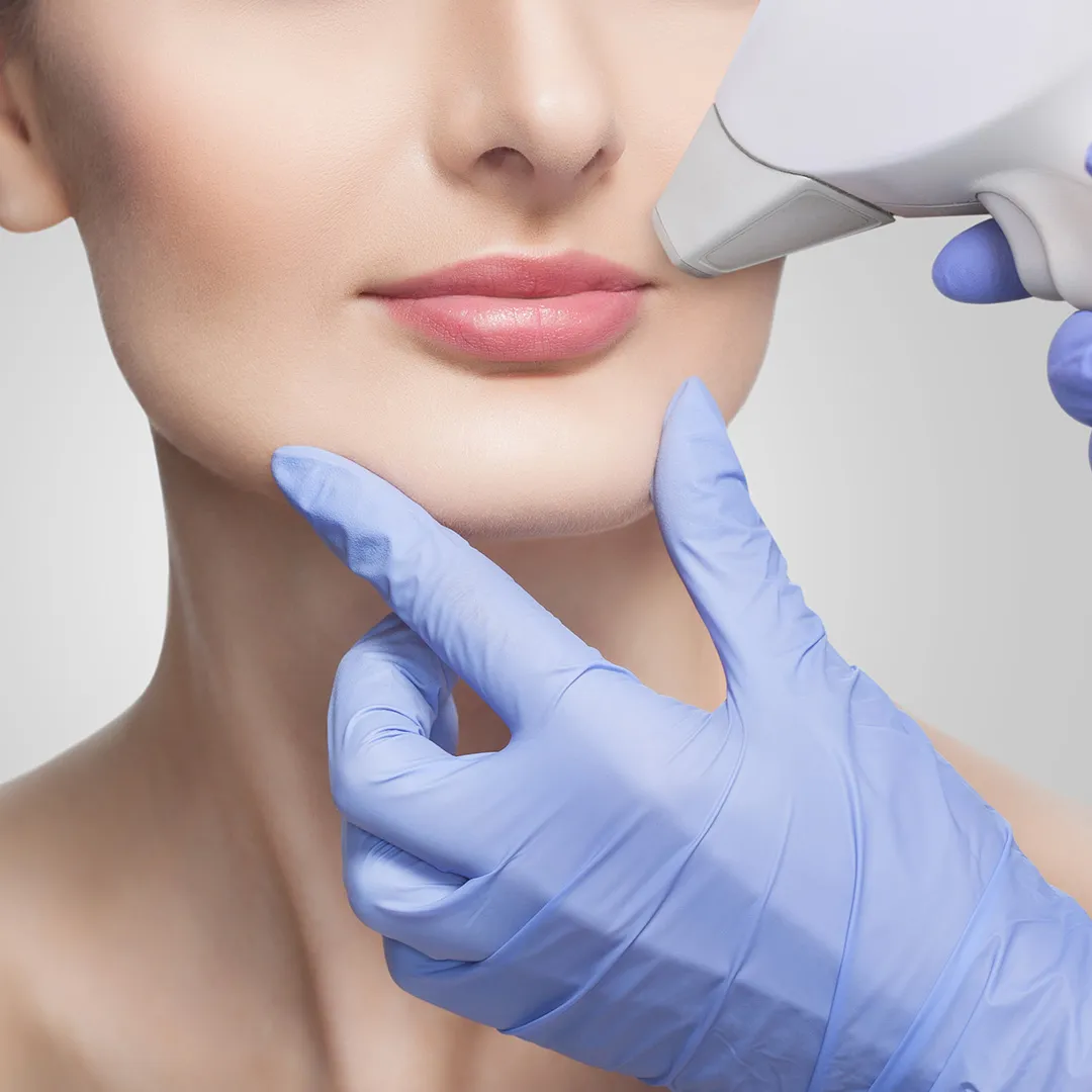 إزالة الشعر بالليزر هي تقنية تجميلية تستخدم أشعة الليزر المركزة لاستهداف بصيلات الشعر، حيث تمتص الصبغة الموجودة في الشعرة الطاقة الضوئية، مما يؤدي إلى إتلاف البصيلة وإبطاء أو منع نمو الشعر مستقبلاً.