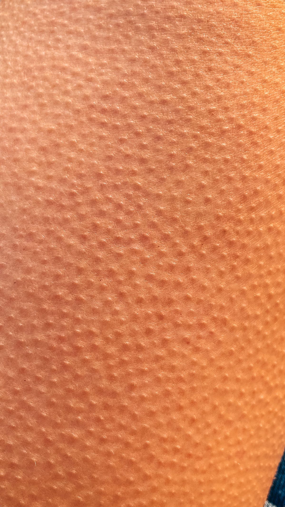 اكتشفي كيف يساعد كريم اليوريا والمقشرات على علاج جلد الأوزة وتنعيم البشرة بفعالية وسهولة في المنزل.