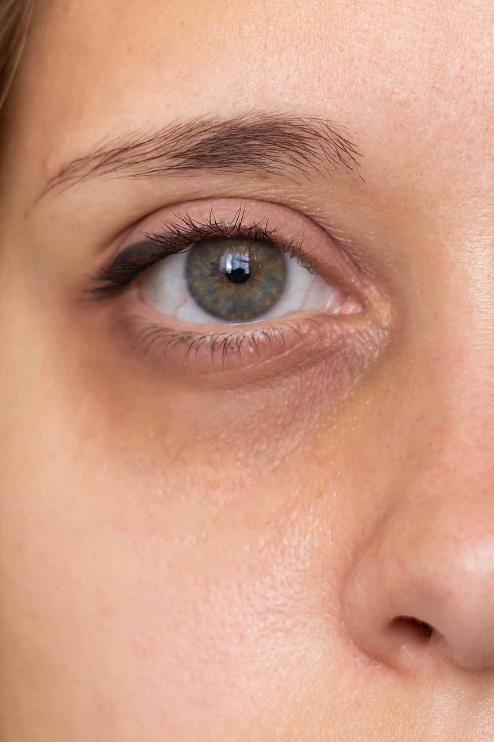 صابون طبيعي للهالات تحت العين مناسب للبشرة الجافة والمختلطة بمكونات مغذية.